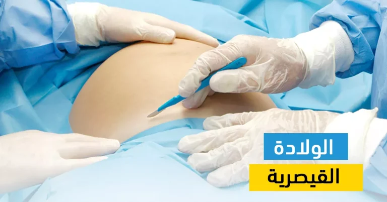 فيلم وثائقي يسلط الضوء على ظاهرة الولادة القيصرية في مصر وتصدرها المرتبة الأولى عالميا!
