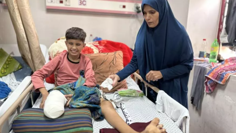 الحرب الإسرائيلية تؤدي إلى ارتفاع حاد في حالات بتر الأطراف في غزة