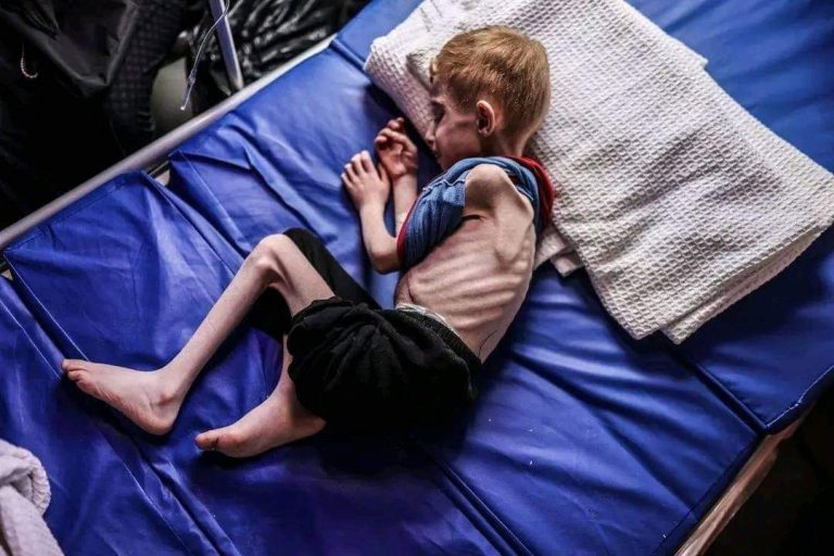 وزارة الصحة الفلسطينية تحذر: 60 ألف طفل في غزة مهددون بسوء التغذية