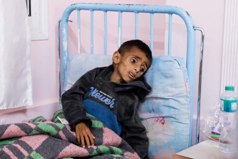 وفاة 66 طفلاً فلسطينياً جراء الحصار الإسرائيلي على غزة يثير صرخة دولية لرفع القيود عن الغذاء والمساعدات