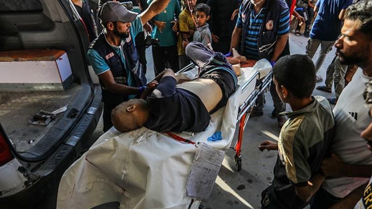 وزارة الصحة في غزة: 179 ضحية بينهم 21 شهيداً نتيجة مجزرة إسرائيلية في رفح
