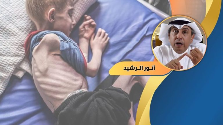 أنور الرشيد يكتب : أيدولوجيات بالية تعصف بمستقبل البشرية . أين فضيلة الإنسانية؟