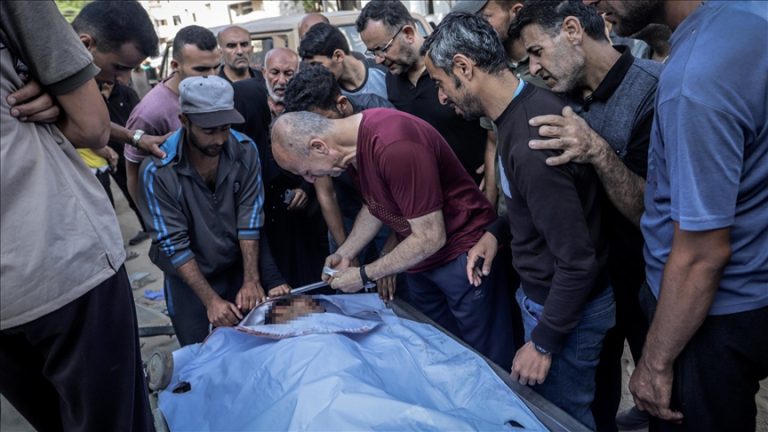 وزارة الصحة بغزة: حصيلة شهداء غزة تتجاوز 57 ألفًا ومجزرة المساعدات تواصل حصد الأرواح