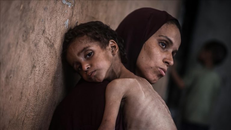 المكتب الإعلامي يحذر: أكثر من 100 ألف طفل مهددون بالمجاعة بسبب نقص الحليب والمكملات الغذائية