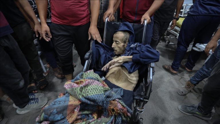 الصحة في غزة: 15 وفاة جديدة بسبب المجاعة بينهم 4 أطفال والحصيلة ترتفع إلى 101 ضحية