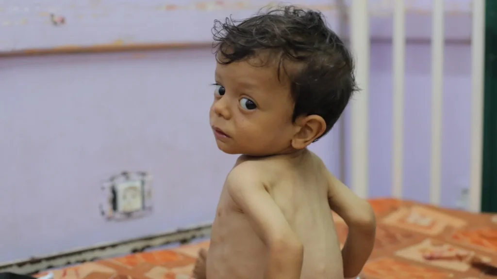 أونروا: لا تغيير ملموس في غزة بعد إعلان الأمم المتحدة دخول القطاع مرحلة المجاعة