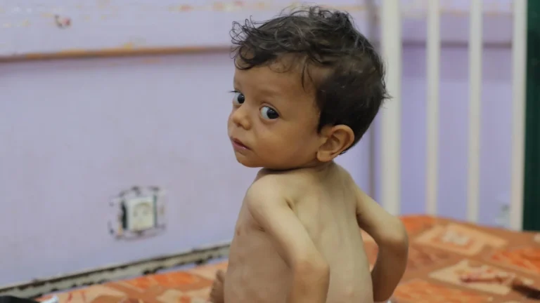 أونروا: لا تغيير ملموس في غزة بعد إعلان الأمم المتحدة دخول القطاع مرحلة المجاعة