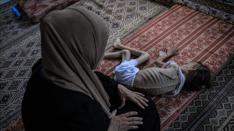 ارتفاع وفيات المجاعة في غزة إلى 169 شهيدًا بينهم 93 طفلًا وسط تحذيرات من انهيار كامل
