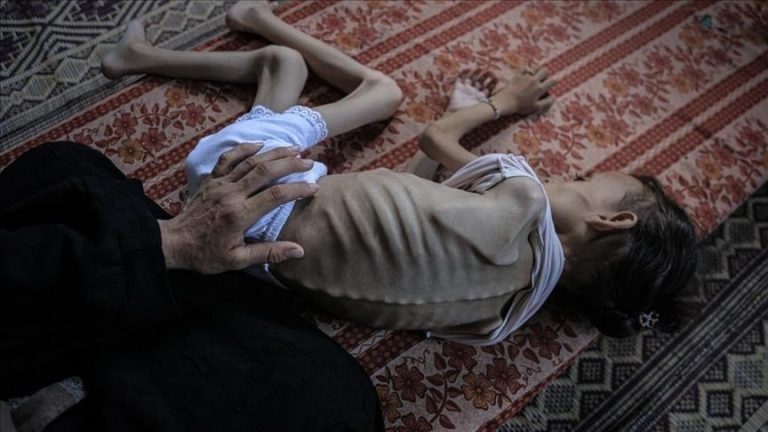 غزة تفند “أكاذيب” إسرائيل بشأن المجاعة: التجويع ممنهج وجريمة حرب