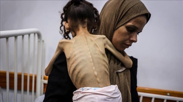 تورك: صور الجوعى في غزة “تمزق القلب”.. وحرمان الغذاء “جريمة حرب”