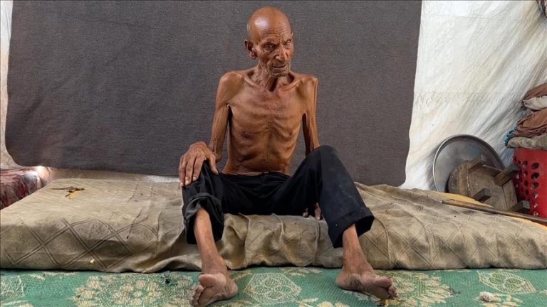 مؤسسات حقوقية دولية تدين إنكار المبعوث الأمريكي للمجاعة في غزة وتطالب بتحقيق دولي فوري