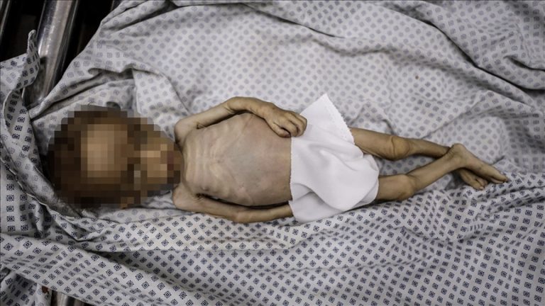 الصحة بغزة: ارتفاع شهداء المجاعة إلى 193 بينهم 96 طفلًا جراء الحصار الإسرائيلي