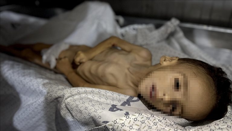 وفاة طفل فلسطيني يزن 3 كيلوغرامات فقط بسبب التجويع الإسرائيلي في غزة
