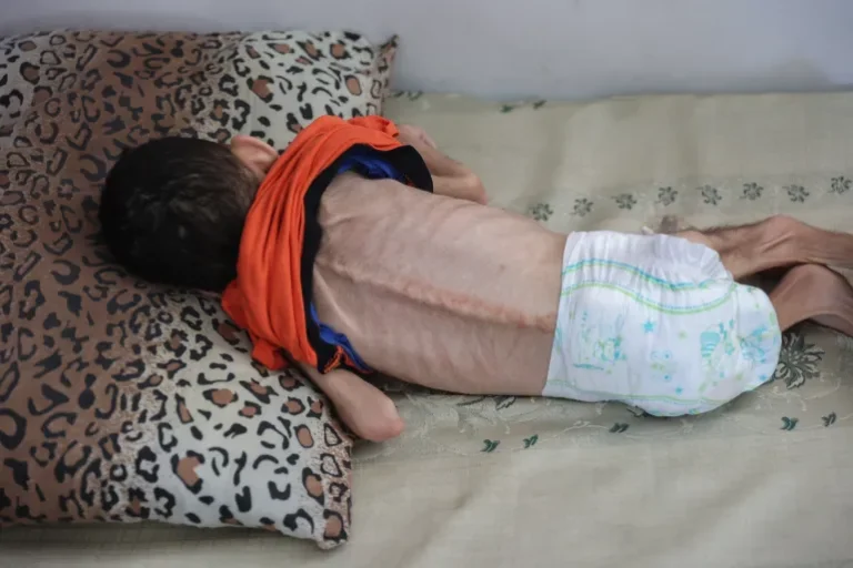 وسائل إعلام أمريكية تكذب ترامب: لم تُحوَّل 60 مليون دولار لغزة… بل 3 ملايين فقط