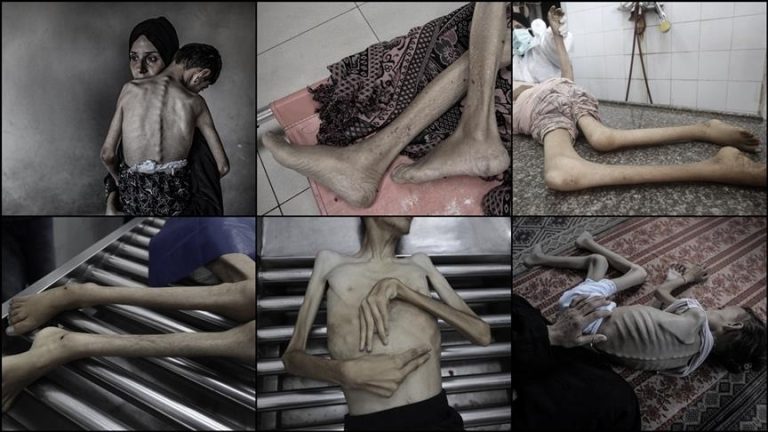 وزارة الصحة: 6 وفيات جديدة جراء التجويع الإسرائيلي في غزة وارتفاع الحصيلة إلى 393 بينهم 140 طفلًا