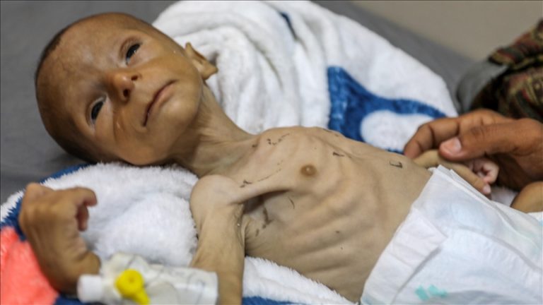 الأونروا: طفل من كل 3 أطفال في غزة لم يتناول أي طعام خلال 24 ساعة