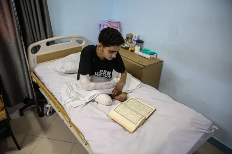 الصحة العالمية: أكثر من 5 آلاف حالة بتر في غزة و42 ألف إصابة غيّرت مجرى الحياة
