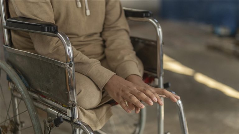 وزارة الصحة في غزة: 6 آلاف حالة بتر خلال عامين من الإبادة الإسرائيلية وربعهم من الأطفال