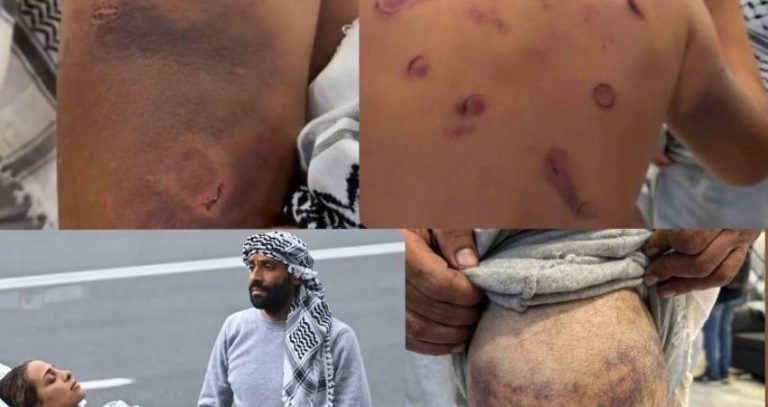 تحقيقات دولية تكشف تفاصيل مروعة حول الاعتداءات الجنسية بحق الأسرى الفلسطينيين