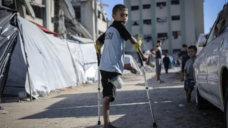 الأمم المتحدة تكشف تفاصيل مؤلمة حول مأساة 43 ألف مصاب في غزة
