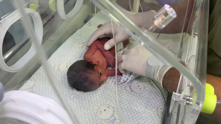 تحذيرات دولية من تزايد حالات الإجهاض في قطاع غزة وسط أزمة إنسانية