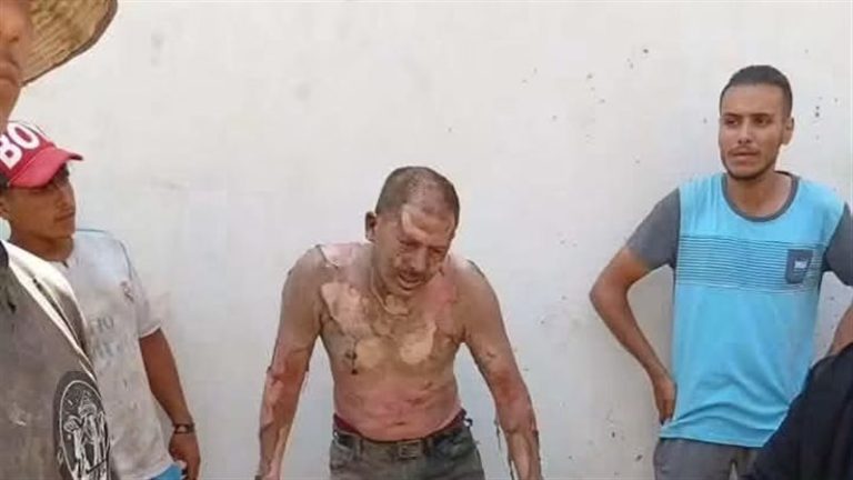 مواطن يشعل النار في نفسه أثناء حملة إزالة بحي المناخ في بورسعيد