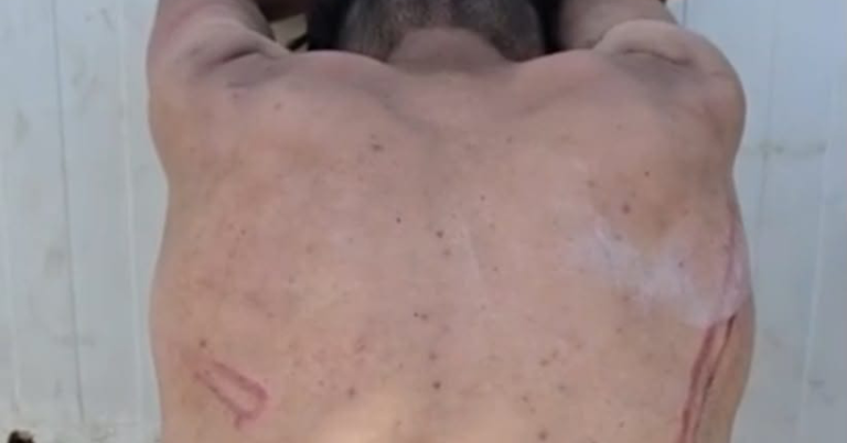 المجلس الوطني لحقوق الإنسان المغربي يرصد انتهاكات سبتة ويكشف تضليل الذكاء الاصطناعي