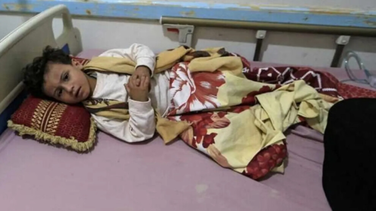 كارثة صحية بـ 16 ألف إصابة بالحصبة وتخوفات من آلاف الوفيات في اليمن