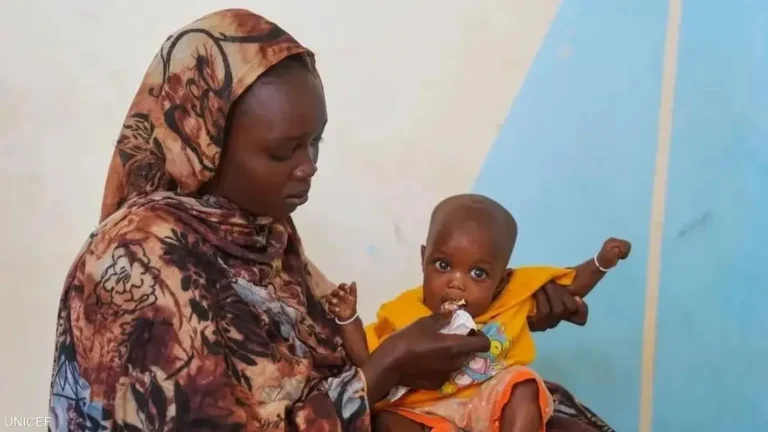 شبح المجاعة يطارد أطفال السودان.. 825 ألف طفل يواجهون خطر سوء التغذية القاتل